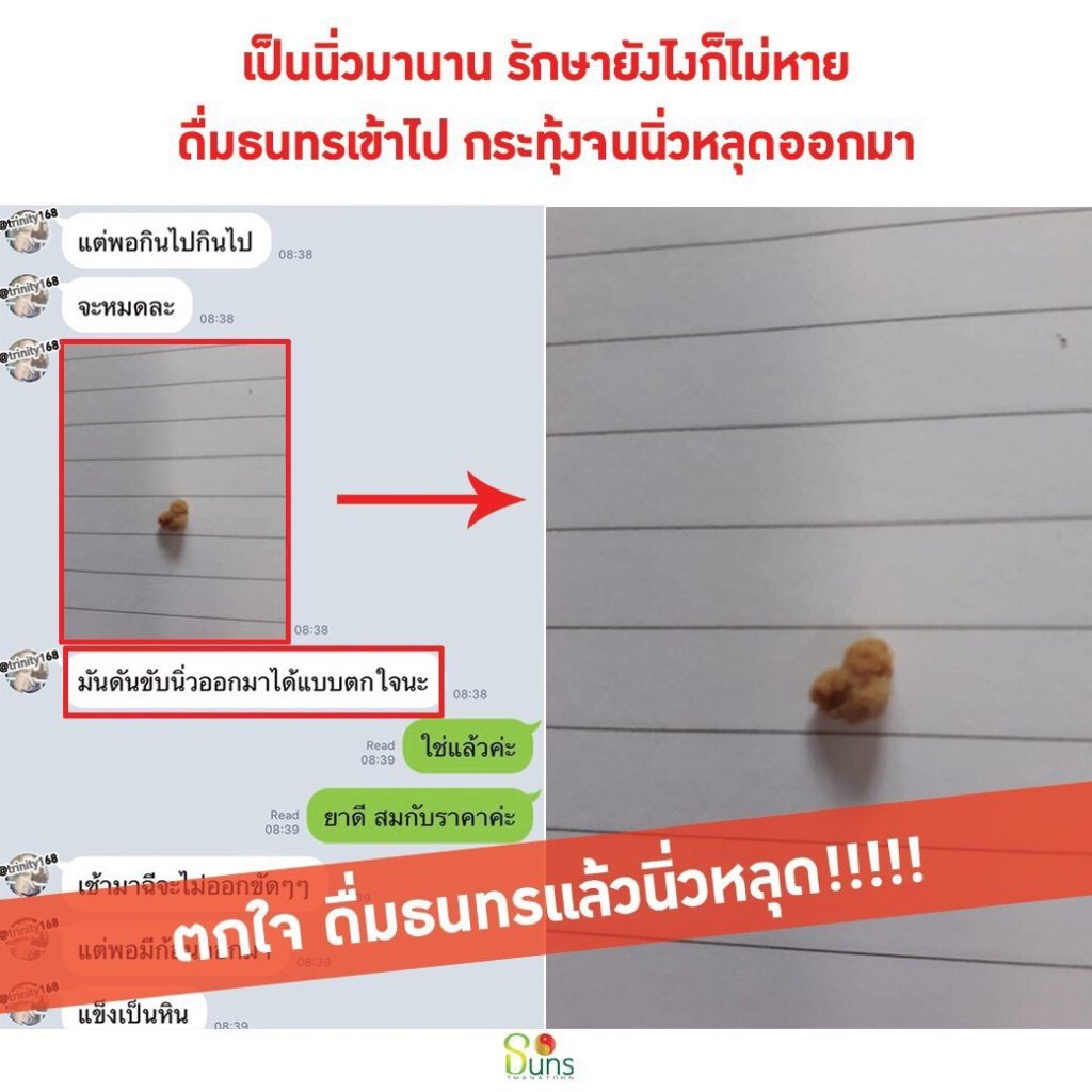 สมุนไพร,ธนทร,นิ่ว,นิ่วในไต,นิ่วในกระเพาะปัสสาวะ,รักษานิ่ว,ปัสสาวะขัด,ยาน้ำ
